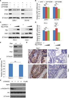 PTEN loss promotes Warburg effect and prostate cancer cell growth by inducing FBP1 degradation